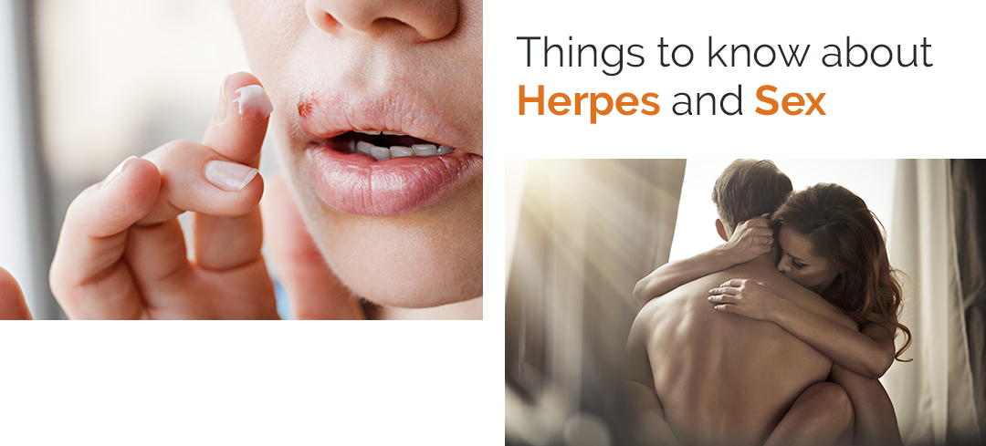 Herpes and Sex - STD Check London